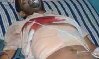 बदमाश ने समाजसेवी को मारी गोली, पुलिस जांच में जुटी...