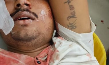 कारोबारी को मारी गोली, BHU ट्रामा सेंटर में चल रहा इलाज...